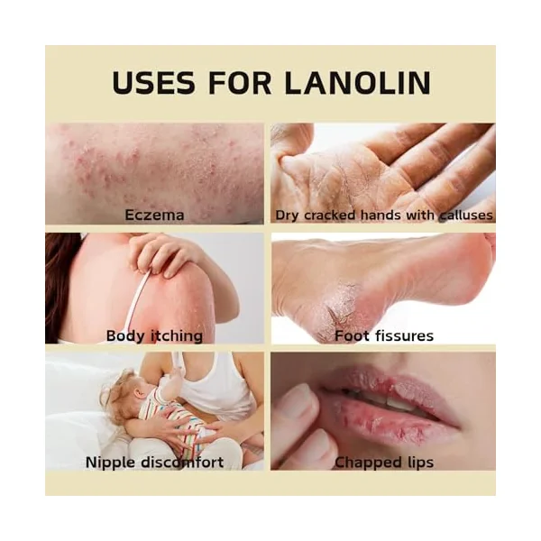 3PCS Natural Lanolin Cream for Hands & Foot,Foot Moisturizer for Dry Cracked Feet/Skin,Lanolin Nipple Cream Lip Balm for Discomfort &Eczema,Skin Barrier Repair Skin Cream Multi-Purpose Soothing Lotion