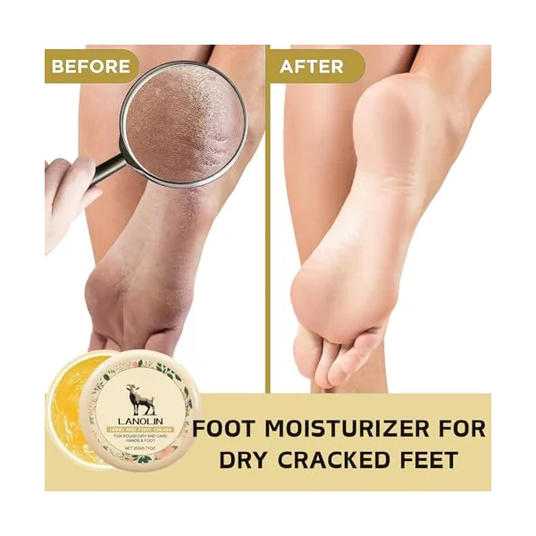 3PCS Natural Lanolin Cream for Hands & Foot,Foot Moisturizer for Dry Cracked Feet/Skin,Lanolin Nipple Cream Lip Balm for Discomfort &Eczema,Skin Barrier Repair Skin Cream Multi-Purpose Soothing Lotion