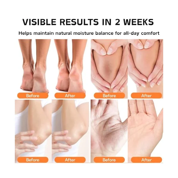 3PCS Natural Lanolin Cream for Hands & Foot,Foot Moisturizer for Dry Cracked Feet/Skin,Lanolin Nipple Cream Lip Balm for Discomfort &Eczema,Skin Barrier Repair Skin Cream Multi-Purpose Soothing Lotion